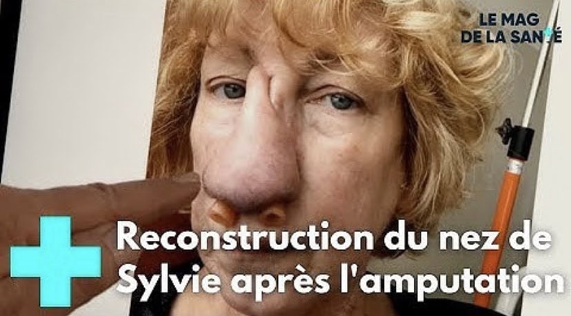 Magazine-de-lasanté-Sylvie