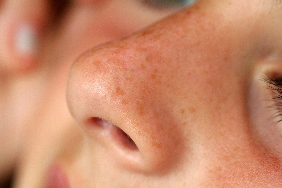 étude-clinique-hpv