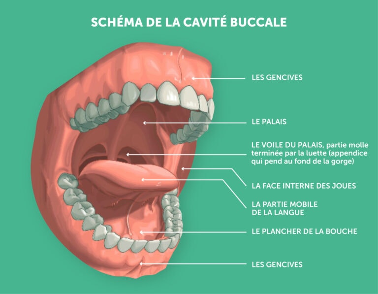 Cancer De La Cavité Buccale Corasso 