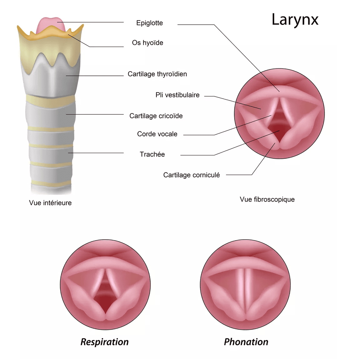 Cancer du larynx 2 schema