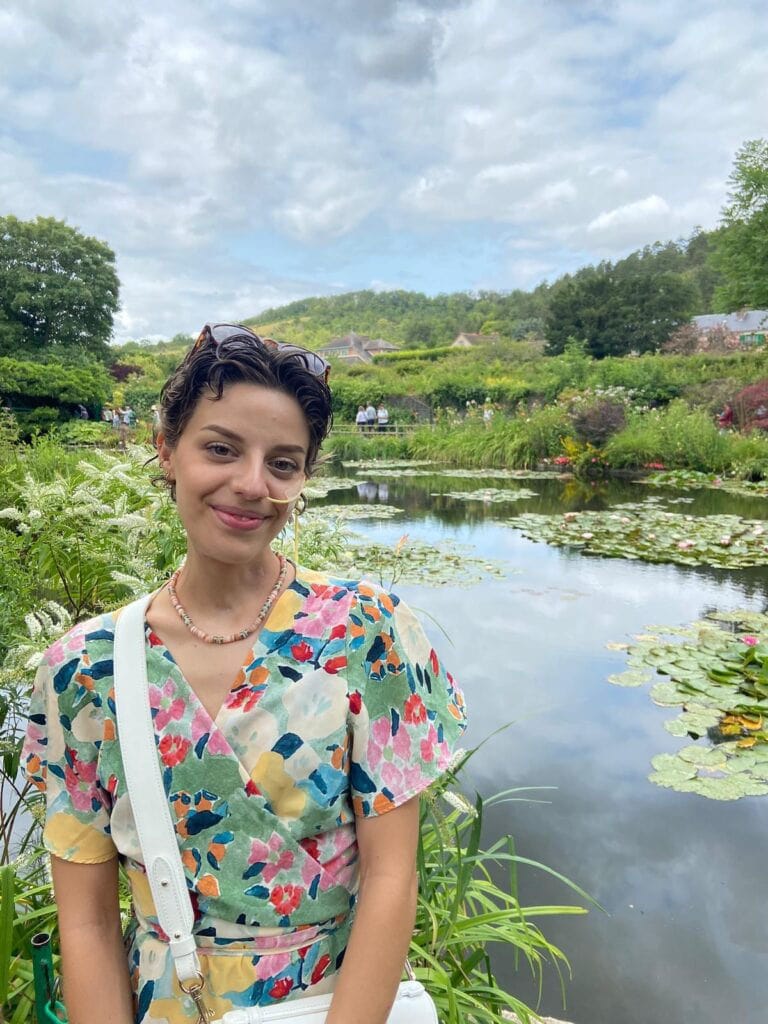 Charlotte-reconstruction-par-lambeau