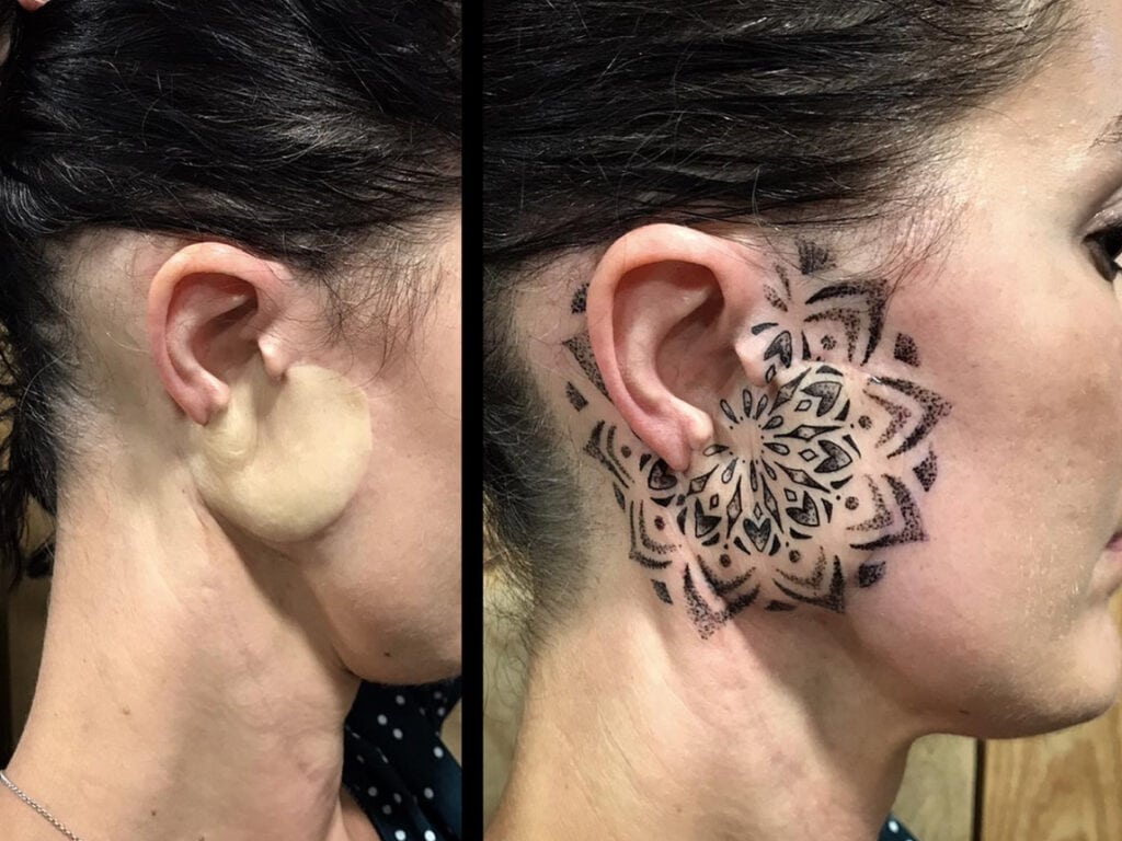 Le tatouage sur greffe 1 tatouage sur greffe