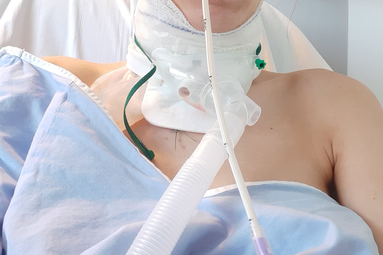 aerosol-gastrostomie