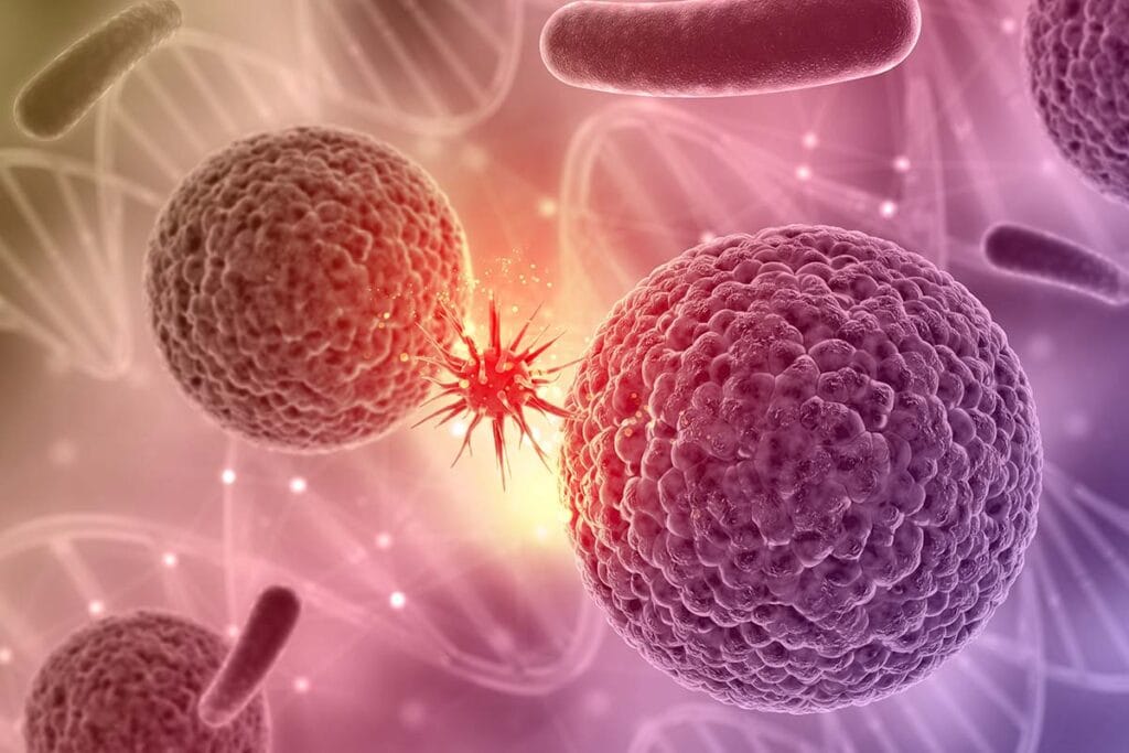 carcinome epidermoide