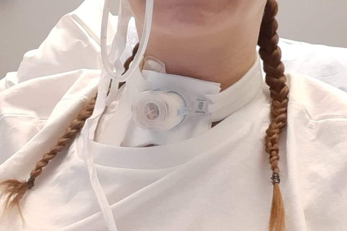 filtre-canule-trachéotomie