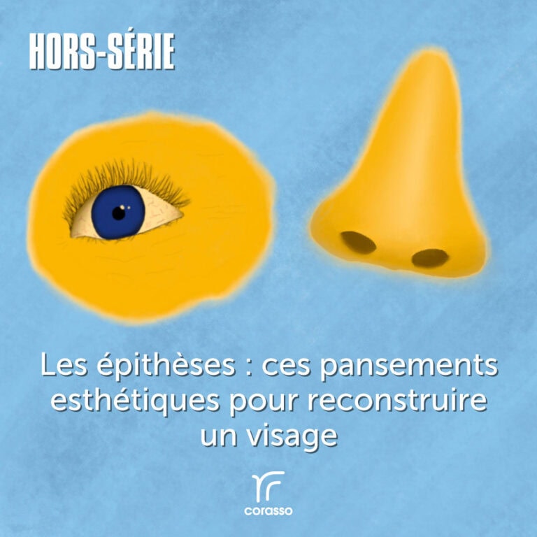 Podcast Cou de Tête-hors-série-épithèse